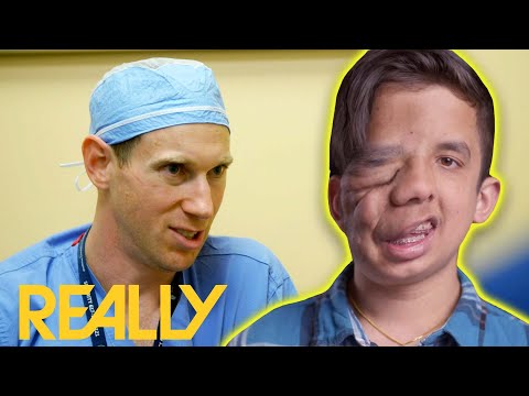 Teenager Undergoes Two Major Surgeries To Align His Jaw | My Brave Face