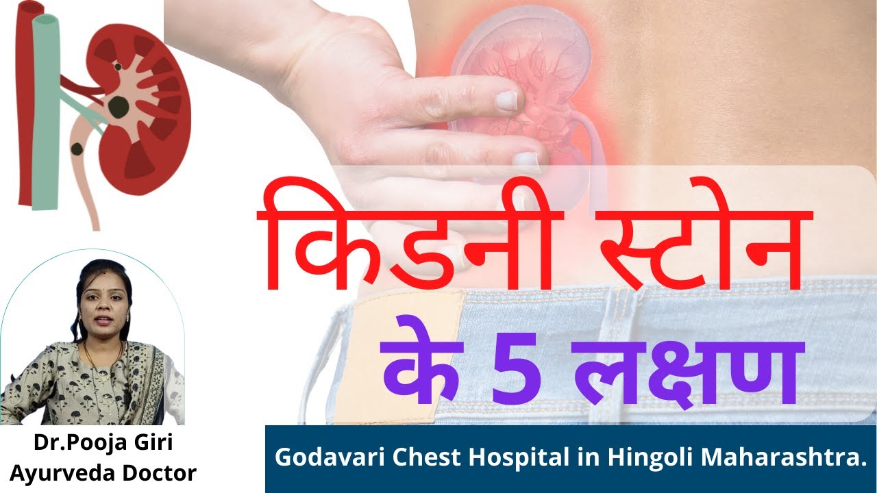 Kidney Stone hone par kya kare signs and symptoms Treatment Dr