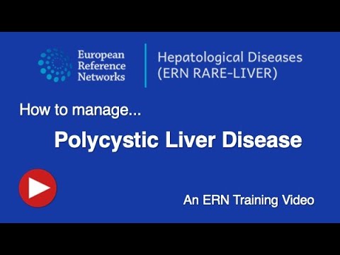 Polycystic liver disease - An ERN RARE-LIVER training video