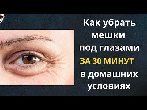 Как убрать мешки под глазами за 30 минут в домашних условиях. Убираем мимические морщины вокруг глаз