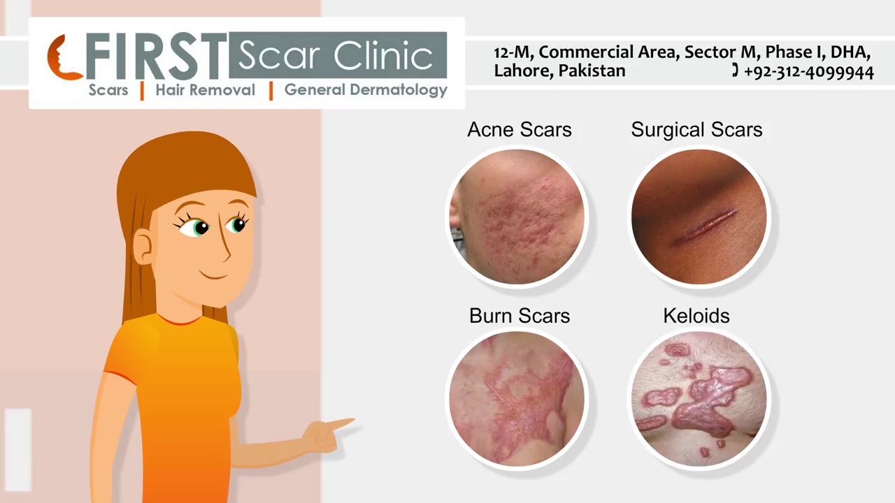 FIRST SCAR CLINIC, Lahore YouTube