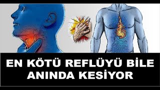 Mide Yanmasını Geçiren Etkili Ve Doğal Tavsiyeler