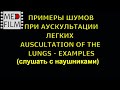 Шумы при аускультации легких (в наушниках) © Auscultation of the lungs, мain and side noise