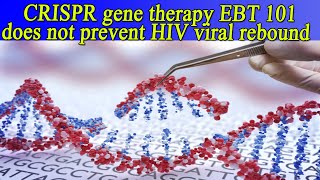 CRISPR gene therapy EBT 101 does not prevent HIV viral rebound