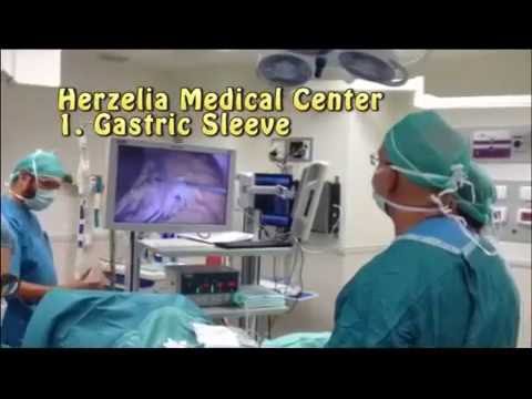 סרטון על ניתוח בריאטרי, מאת ד"ר הדר ספיבק