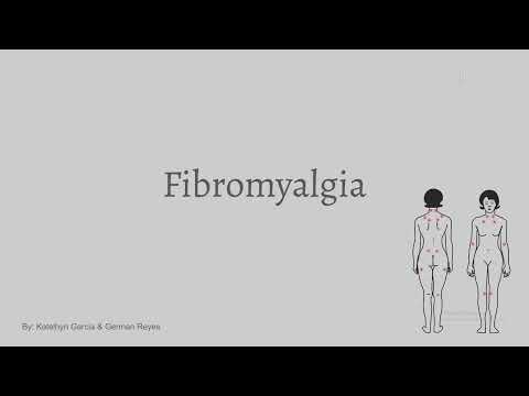 Presentation of Fibromyalgia #shorts