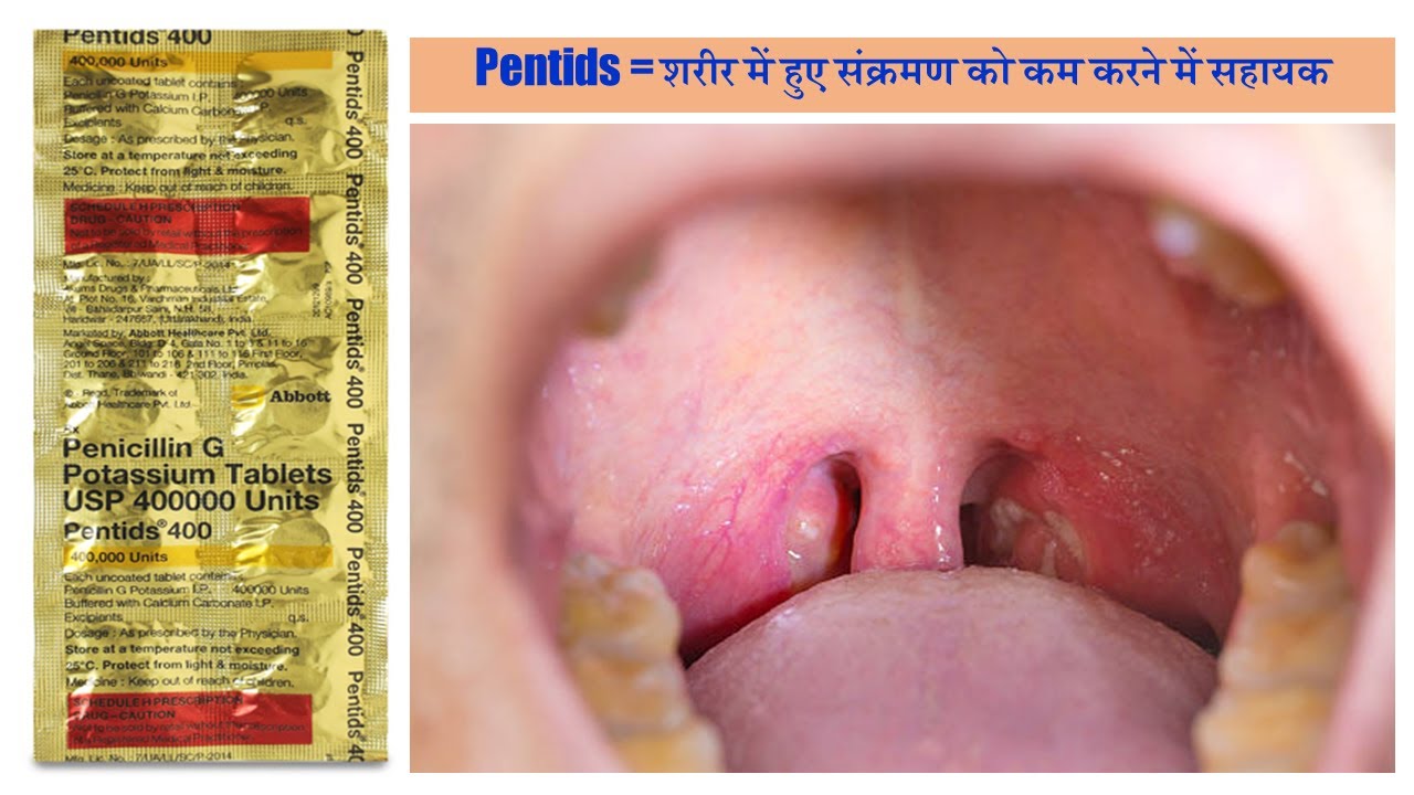 pentids-400-tablet-penicillin-g-or-benzylpenicillin