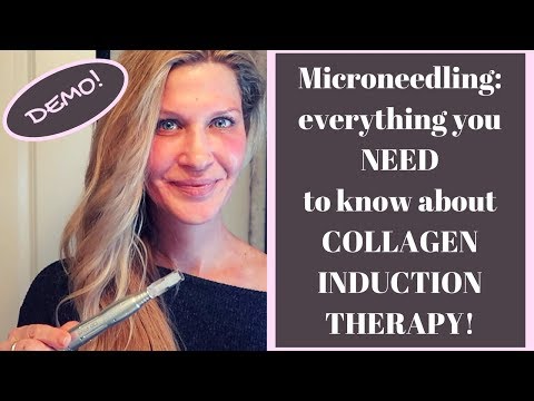 CIT/MICRONEEDLING for MATURE SKIN or ACNE SCARS! You need to know about COLLAGEN INDUCTION THERAPY