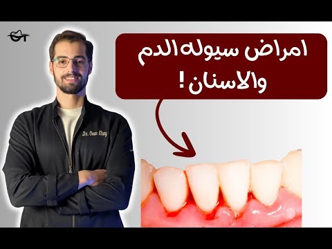 تأثير امراض سيوله الدم على صحه الفم والاسنان اهم التعليمات قبل زياره طبيب الاسنان