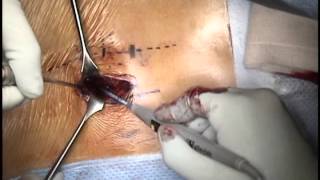 Lisandro Chiavassa-13