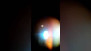 Labomed slit lamp use mobile adapter funds