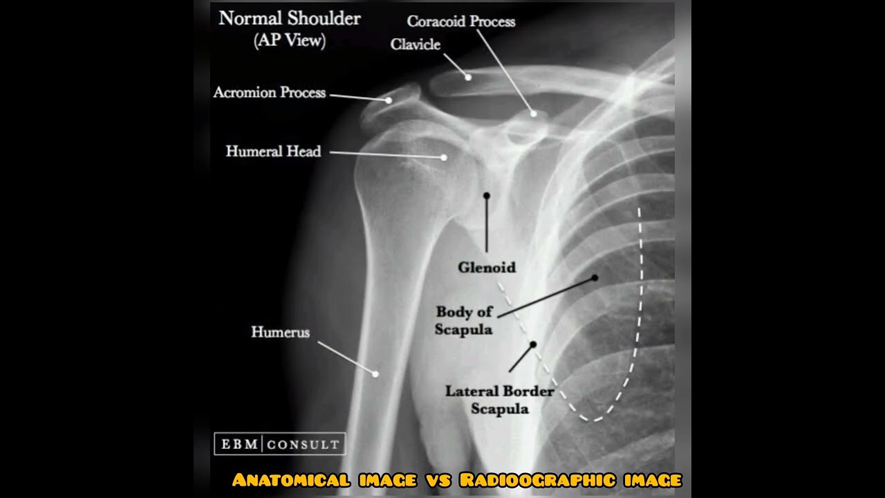 ANATOMICAL IMAGE VS RADIOOGRAPHIC IMAGE || SHOULDER AP ||