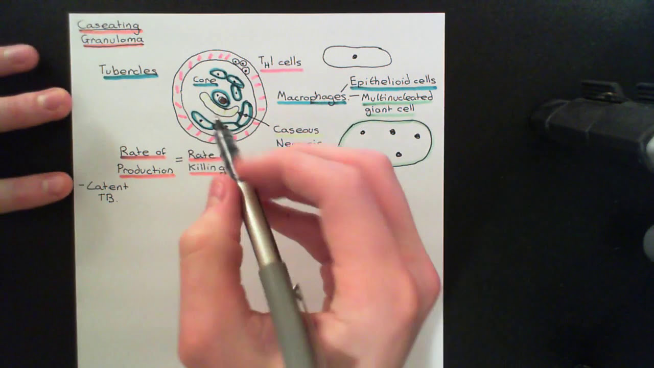 Tuberculosis and Antituberculosis Drugs Part 6