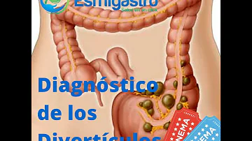 ¿Se puede detectar la diverticulitis con una colonoscopia?