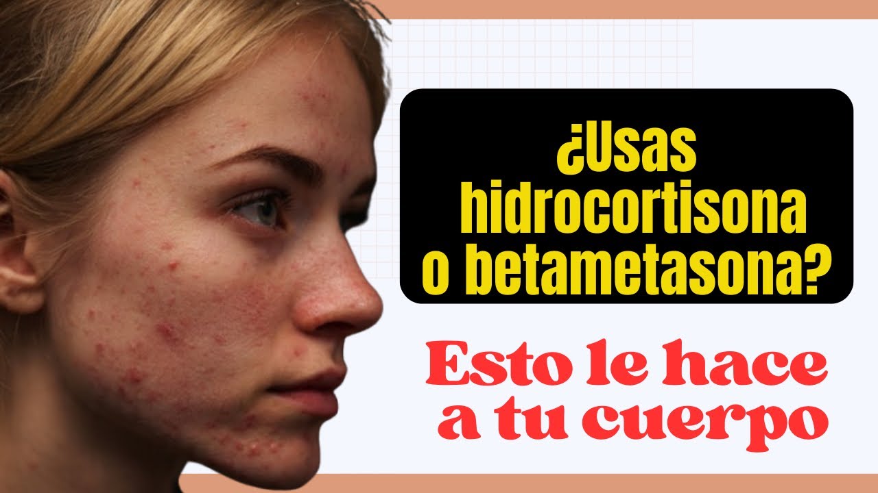 Uso de cremas para la dermatitis y sus consecuencias 