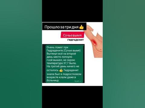 Сучье вымя или Гидраденит, что поможет? - YouTube