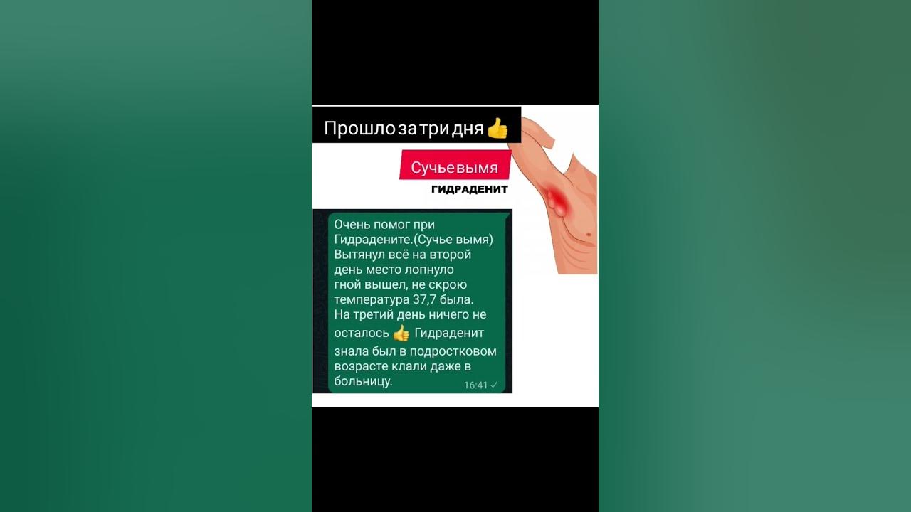 Сучье вымя или Гидраденит, что поможет? - YouTube