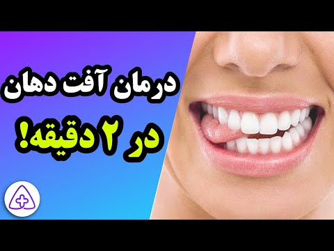 چگونه آفت دهان را سریع با روش های طبیعی درمان کنیم