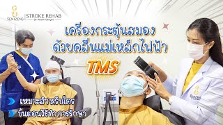 การกระตุ้นสมองด้วยคลื่นแม่เหล็กไฟฟ้า (TMS) ช่วยฟื้นฟูผู้ป่วยโรคหลอดเลือดสมอง