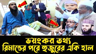 রিমান্ডের পরে মামুনুল হকের একি হাল হল দেখুন  ৪বছর জেল  live news  Allama Mamunul Haque news today