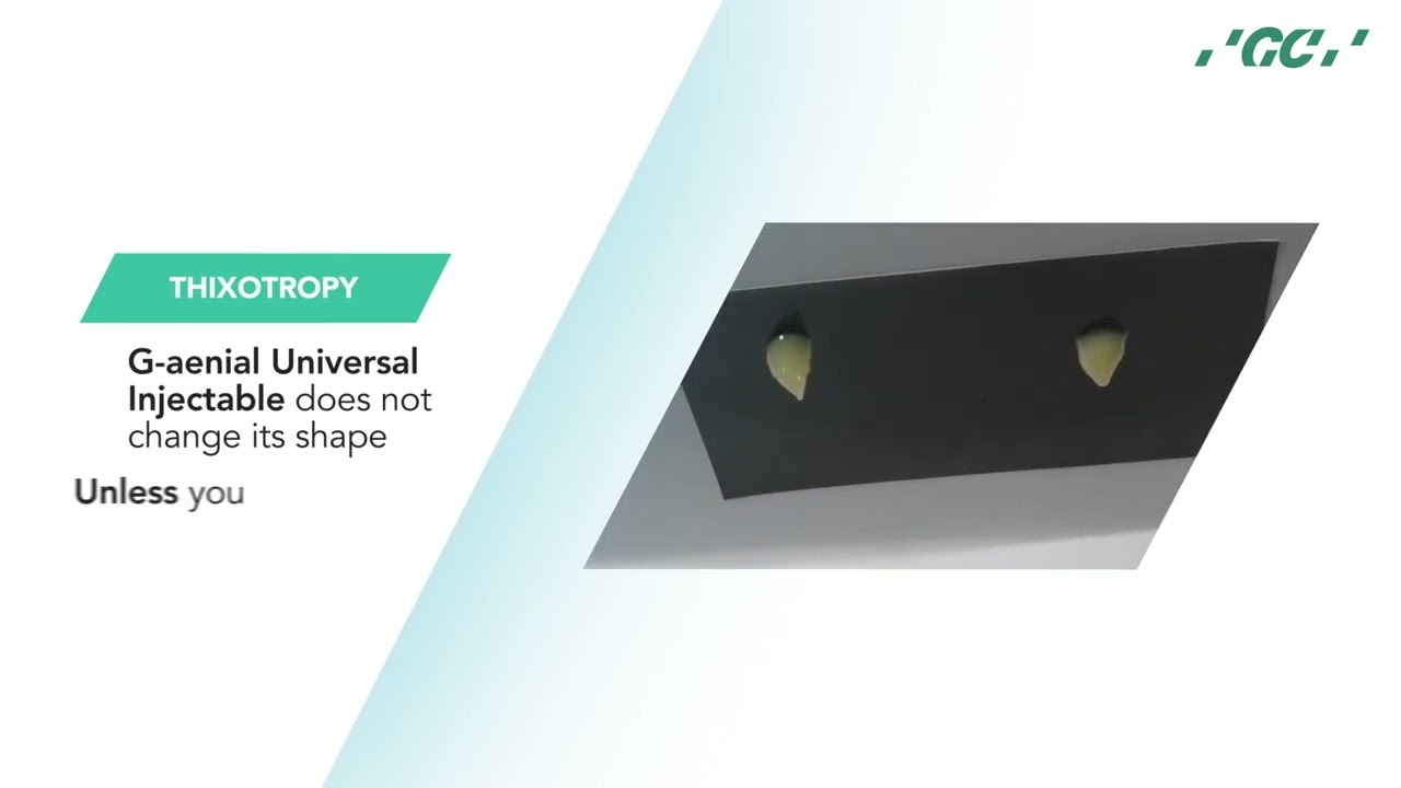 GC's Direct Restorative Solutions - G-ænial™ Universal Injectable vs. Competitors