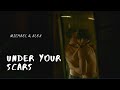 Under Your Scars | Michael & Alex