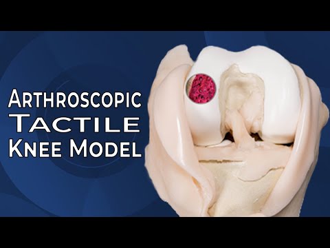 Technical Features of the Arthroscopic Tactile Knee with Dr. Ryan Martin, MD, FRCSC