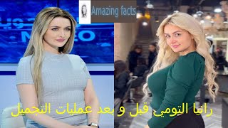 رانيا التومي قبل و بعد عمليات التجميل، Tunisian actress Rania Toumi before and after plastic surgery