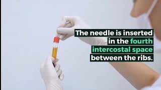 Intracardiac Injection