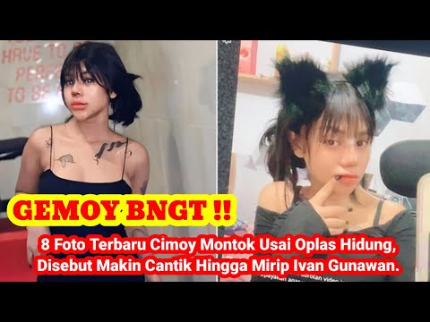 8 Foto Terbaru Cimoy Montok Usai Oplas Hidung, Disebut Makin Cantik Hingga Mirip Ivan Gunawan