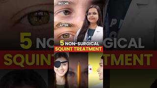 5 Non-Surgical Ways To Treat Squint Eyes