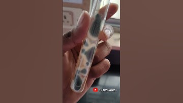 Fungal culture | mycology |SDA fungal culture medium | tjbiologist | microbiology | biology|science