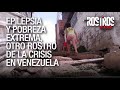 Epilepsia y Pobreza Extrema en Venezuela - Rostros de la Crisis