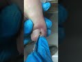 nails grow small eyes