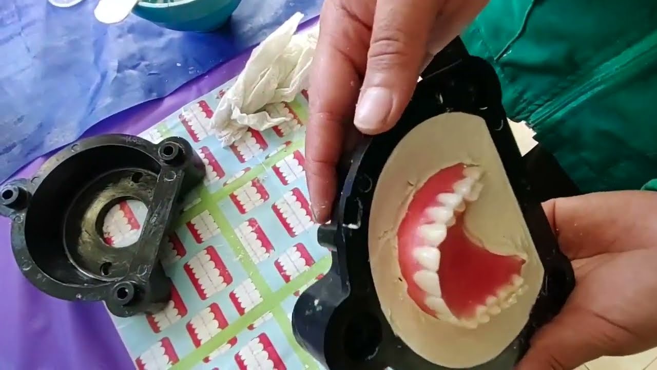 Proceso de enmuflado y descencerado de una prótesis dental total, removible.Laboratorio dental Prada