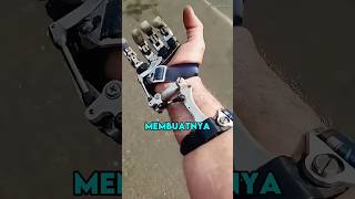 Dia Membuat Sendiri Tangan Prostetik Setelah Kehilangan Jarinya