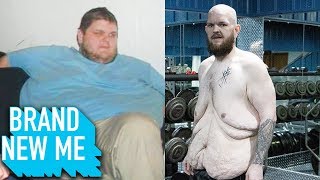 I Lost 227lbs And I'm PROUD Of My Excess Skin | BRAND NEW ME