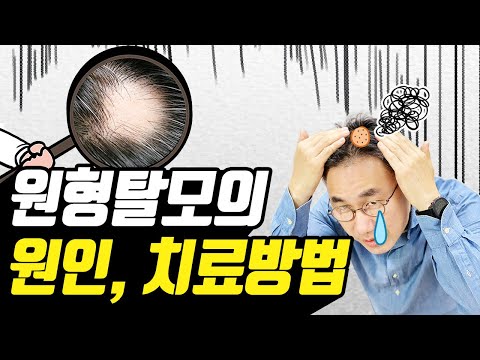 원형탈모의 원인과 치료방법을 알려드립니다. 👉원형탈모, 난치성탈모는 치료가 됩니다.👈