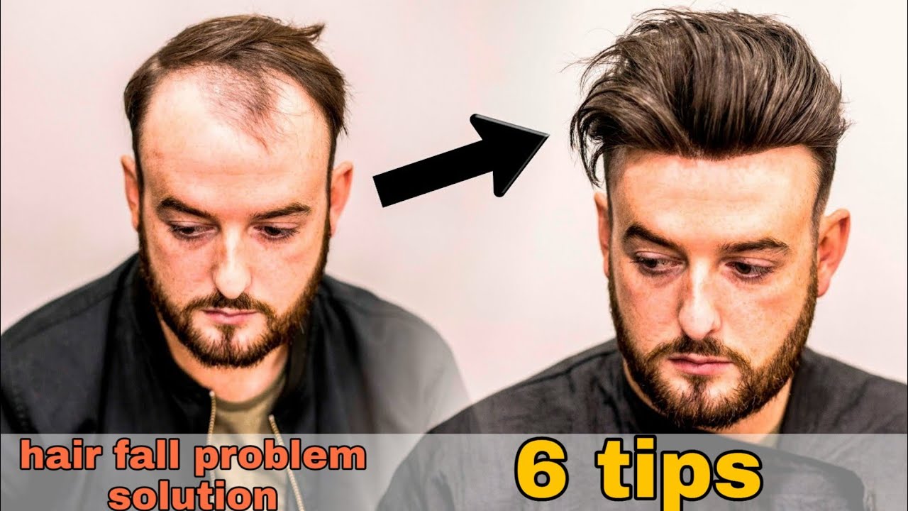 6 TRICKS TO MAKE YOUR HAIR GROW FAST ||HOW TO SOLVE HAIR FALL PROBLEM