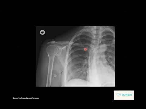 Erişkin Omuz Röntgeni Yorumlama Teknikleri