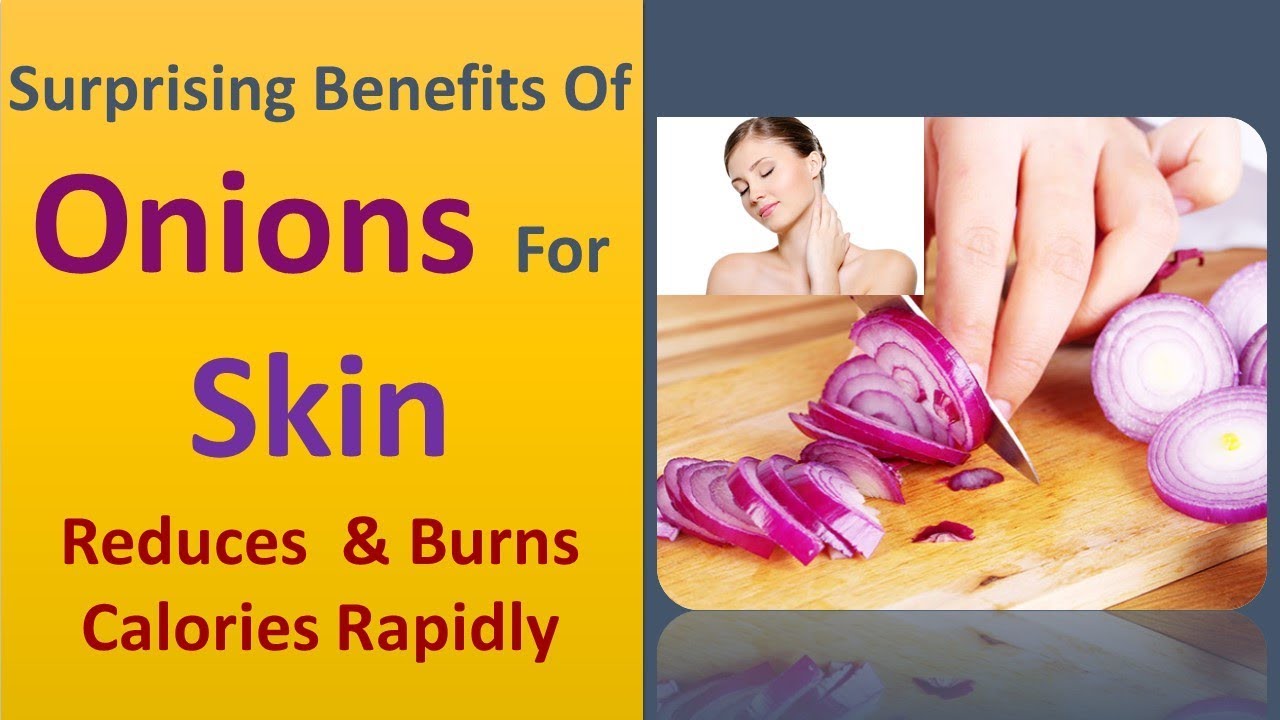 Surprising benefits of onions for skin Reduces & Burns calories
