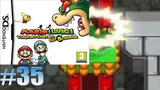 Balancín de aplastamiento/Mario y Luigi: Viaje al Centro de Bowser #35