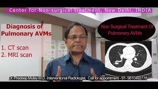 Pulmonary AVMs, Arterio-venous Malformatiion