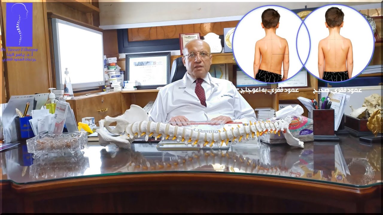 Dr. Yasser Elbanna (اعوجاج العمود الفقري)