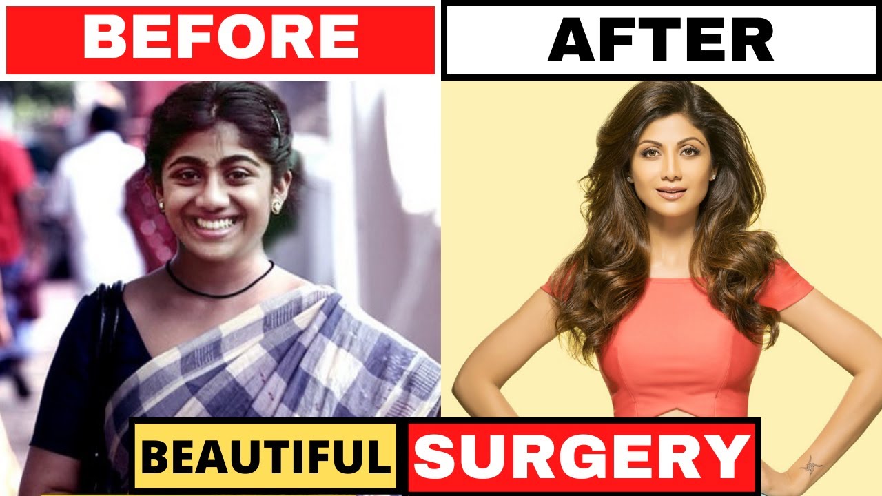 SHOCKING Plastic Surgery of South Indian Actresses BEFORE & AFTER