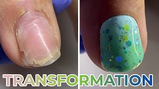 ✨157✨Incredible Nail Transformation Acrylic Nail Art Designs Compilation 💅