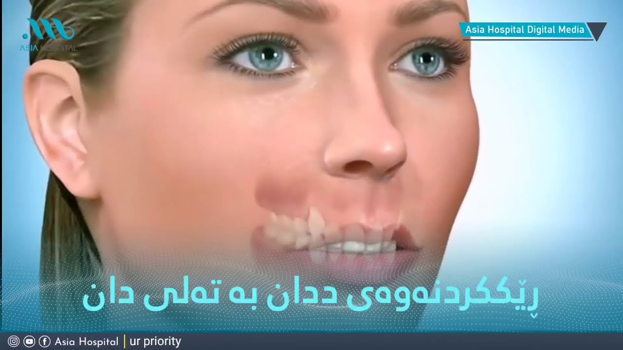 ڕێککردنەوەی ددان بە تەلی دان