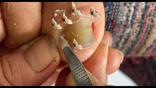 How to Repair Nails easy 187 - Xuyen Nail