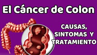 EL CÁNCER DE COLON, Causas, signos y síntomas, diagnóstico y tratamiento