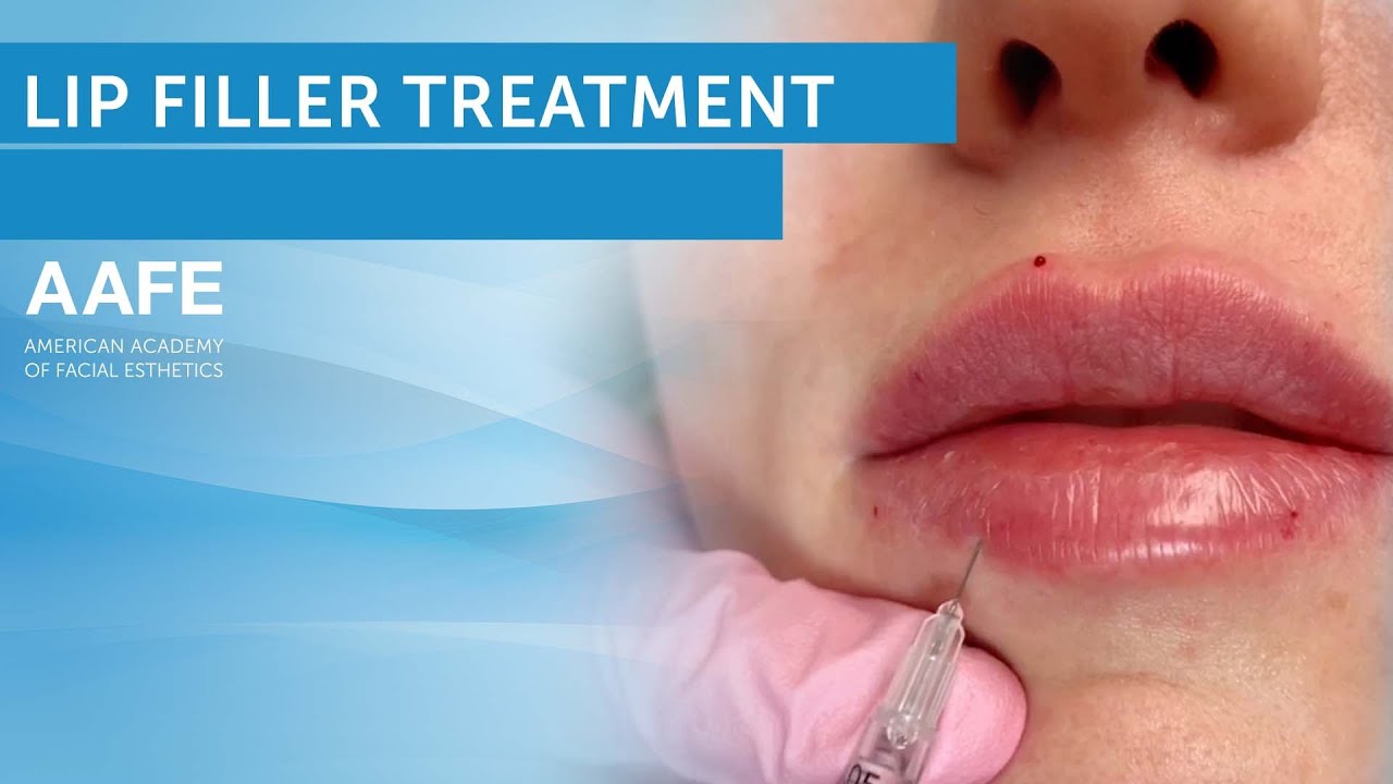Lip Filler Tutorial YouTube